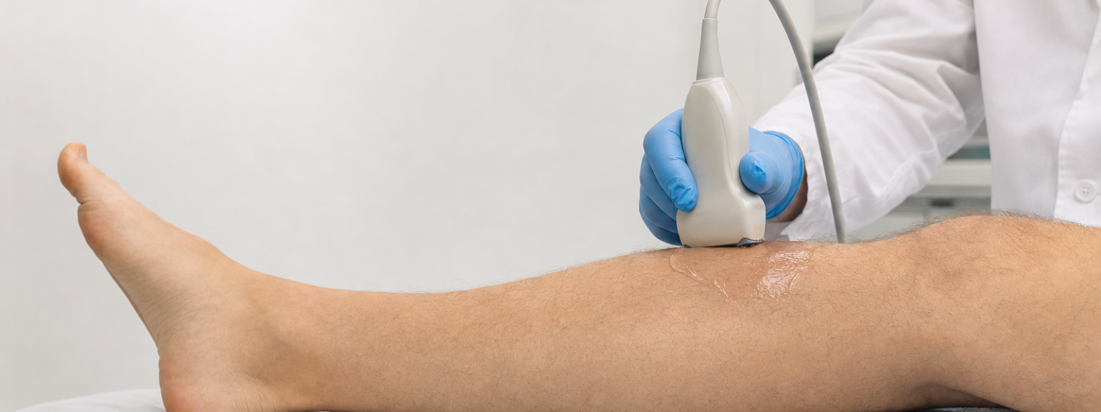 Ultrassom Doppler da perna para avaliação da circulação arterial